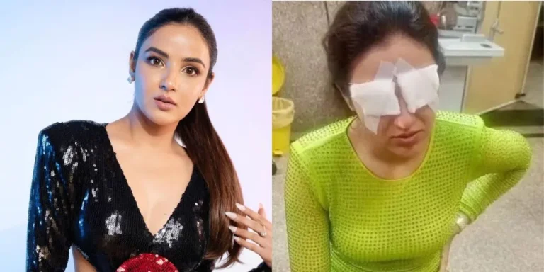 Jasmine Bhasin Battles Corneal Damage After Contact Lens Mishap